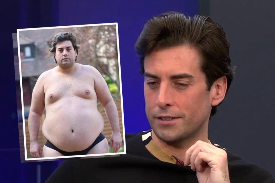 James Argent, before and after (ES Composite)