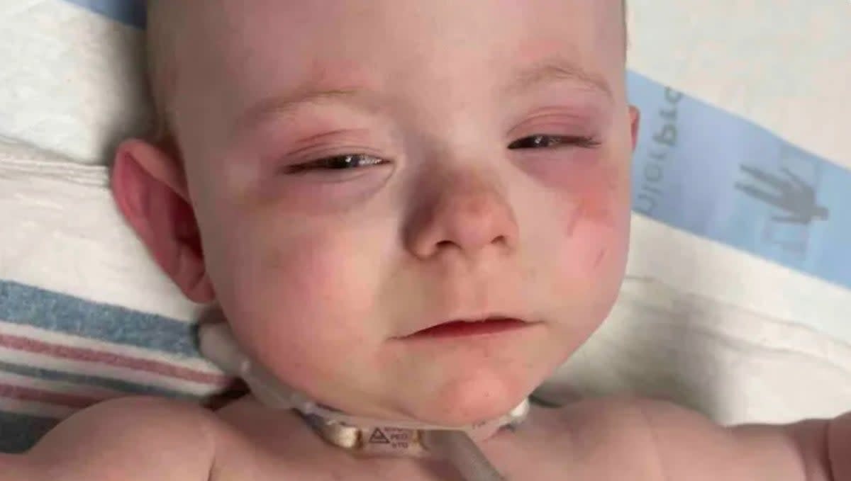 Waylon, the 17-month-old baby boy, who was allegedly harmed by police in a mistaken raid. (GoFundMe)