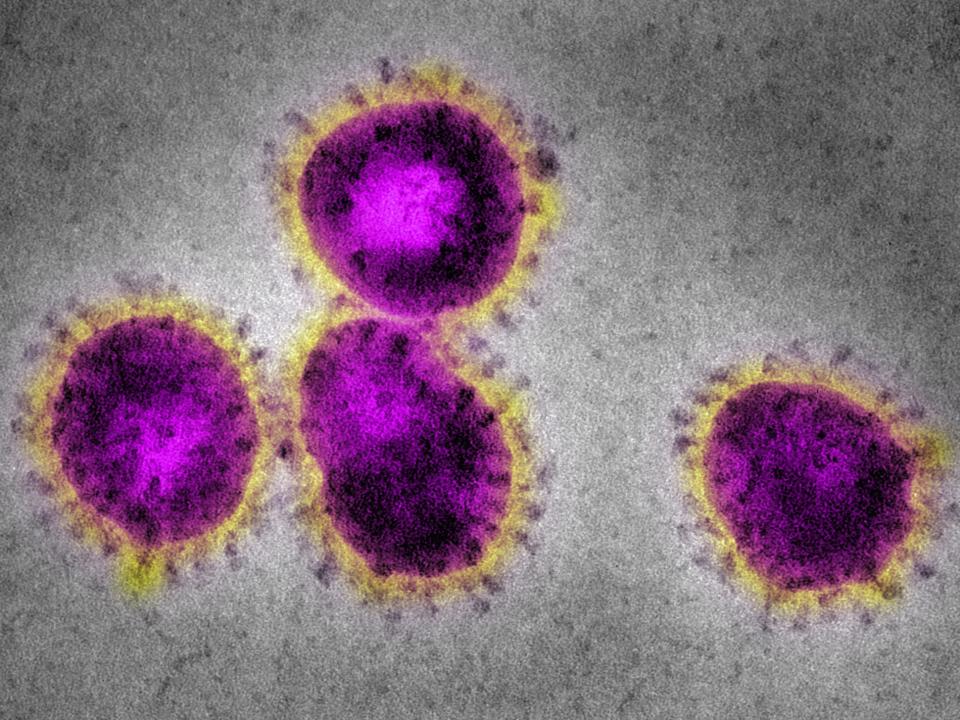 coronavirus image SARS organism cell