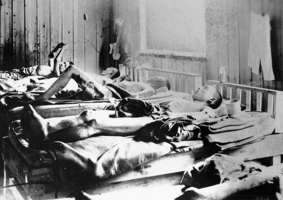 Survivors of the explosion of the Atom bomb at Hiroshima 1945 suffering the effects of radiation. ICRC photograph. (Universal History Archive via Getty Images)