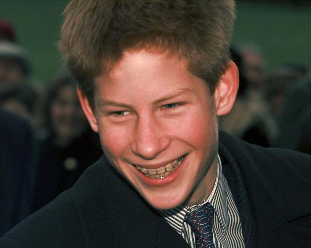 24 Celebrities Who Had Braces