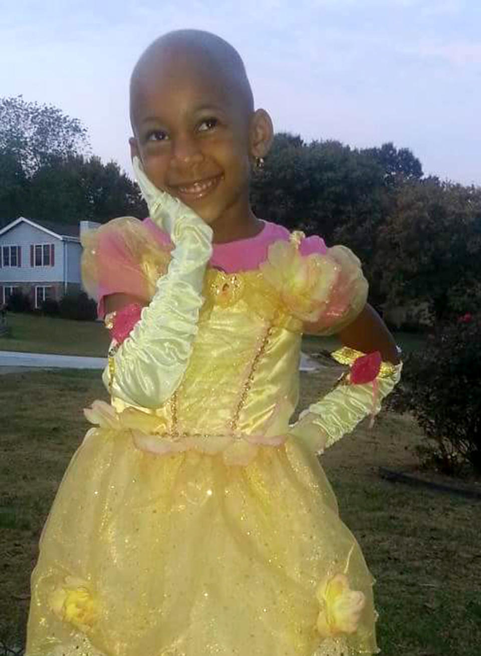 Bald and beautiful. Talyah Moe has endured bullying but still manages to smile. (Photo: Courtesy of Shondelle Moe)