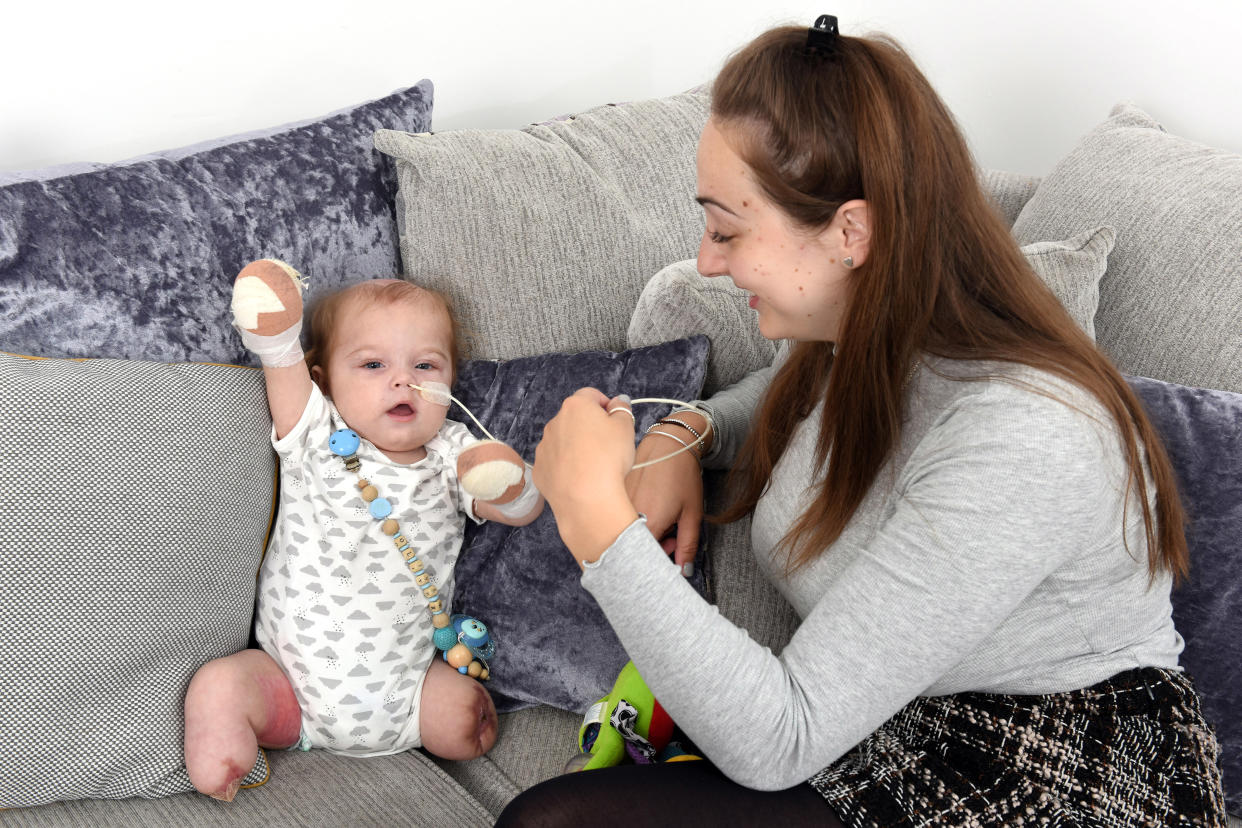 Little Oliver is now recovering at home after losing his limbs to sepsis [Photo: Caters]