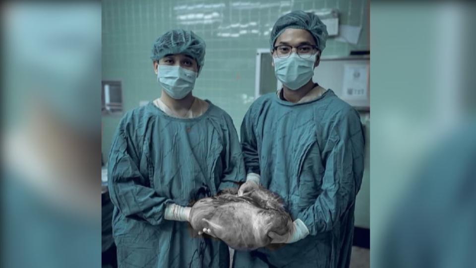 醫師從女童體內切除長達60公分的腫瘤。（圖／翻攝自Nath Kaitaphiwasu臉書）