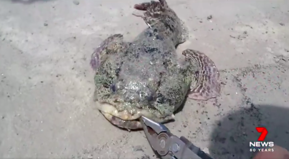 Tourism Whitsundays is adamant the bite was from a toadfish. Source: 7News