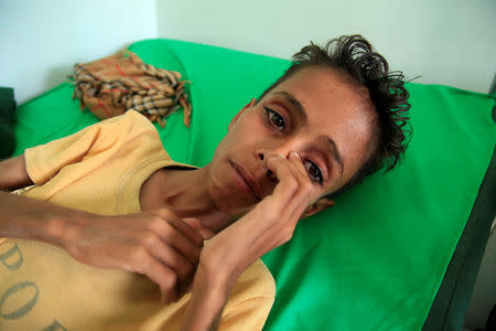 Malnourished Ghazi Ahmad, 10, lies on a bed at a hospital in Taiz, Yemen October 30, 2018. Picture taken October 30, 2018. REUTERS/Anees Mahyoub