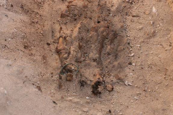 This copper alloy ring was found on the second toe of the male's right foot, the same foot that suffered a fracture when he was alive. His right femur was also fractured and never healed properly causing him great pain.