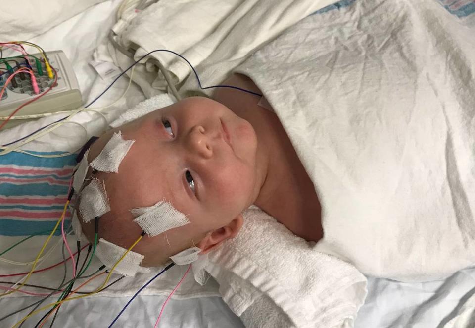 Jackson Moore underwent his first EEG on Aug. 9, 2019.