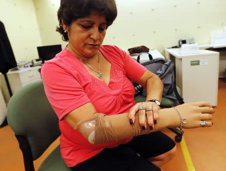 Stella Azambullo, who lost her left arm seven years ago in an accident, puts on a prosthetic arm at the Bioparx Health Technology company in Santa Fe, north of Buenos Aires December 18, 2014. REUTERS/Enrique Marcarian