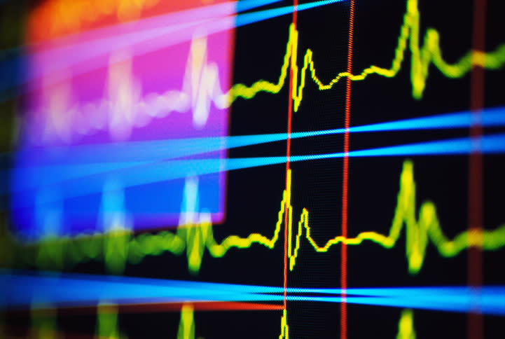 A close-up image of colorful electrocardiogram (ECG) waveforms displayed on a medical monitor screen