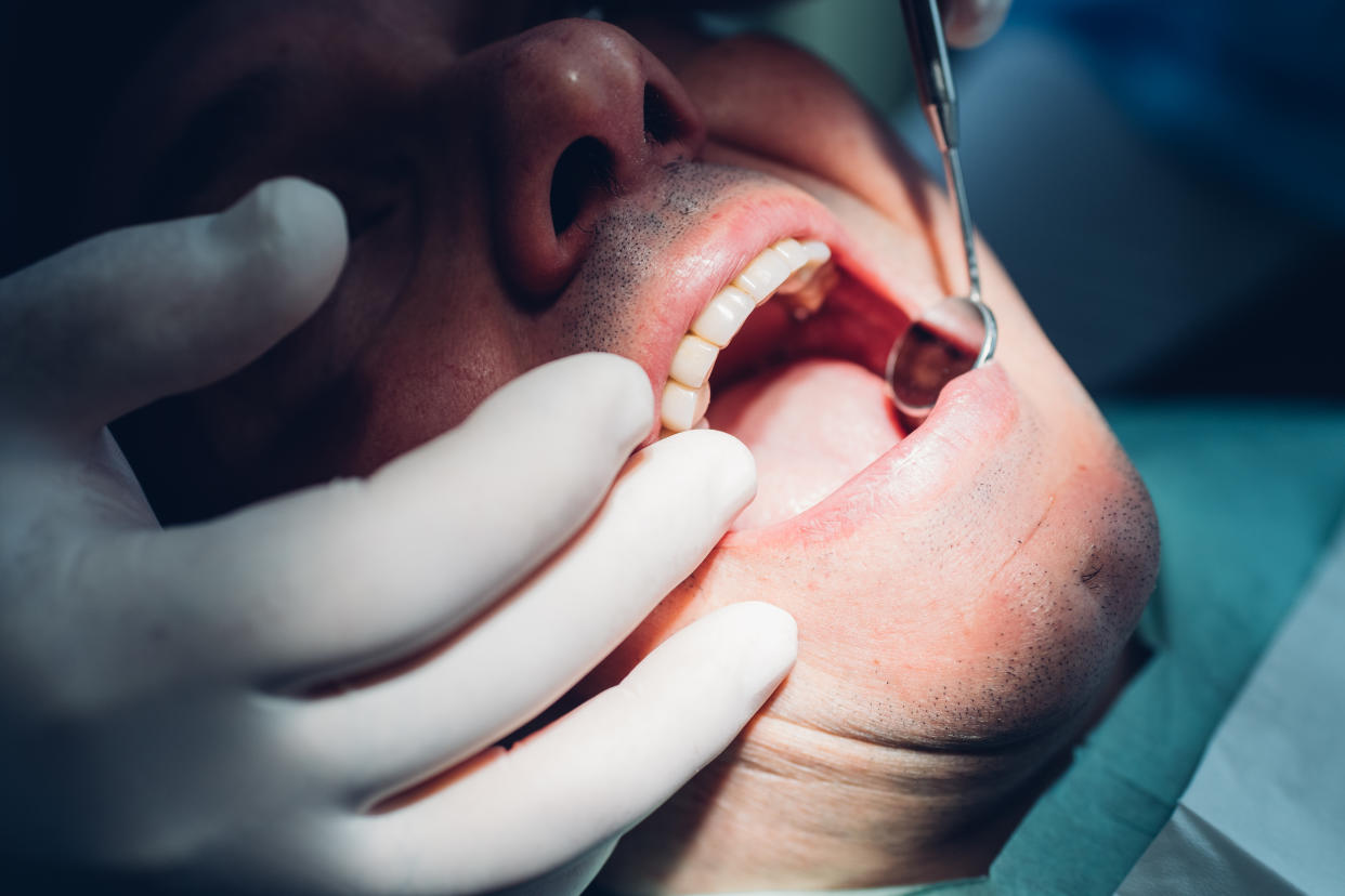 Dentist carrying out dental procedure on male patient, close-up