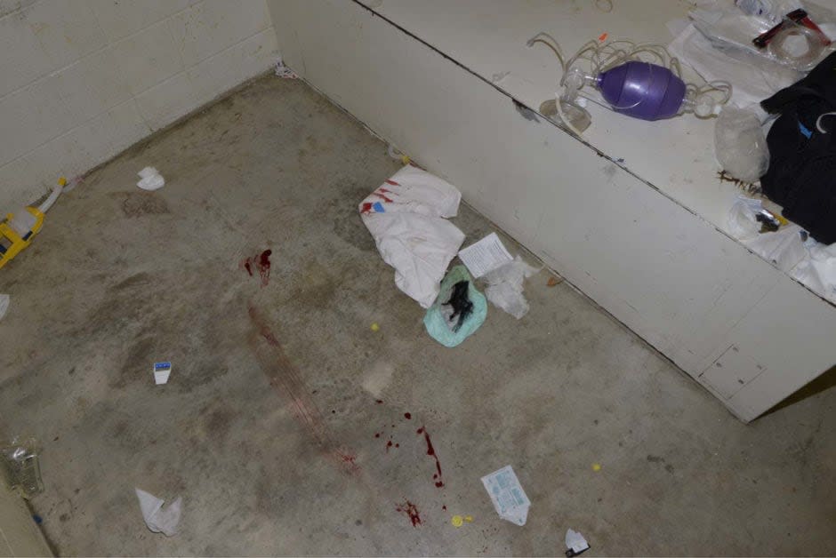 There is no footage of what took place inside Soleiman Faqiri's cell on the day he died. These blood smears were among the hundreds of photos of the scene taken by investigators following Faqiri’s death and obtained by The Fifth Estate.  (Kawartha Lakes Police Service - image credit)