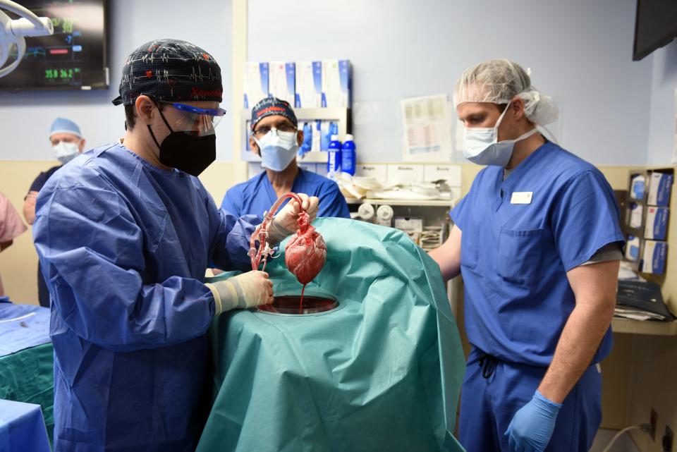 This handout photo released by the University of Maryland School of Medicine on January 10, 2022 shows surgeons performing a transplant of a heart from a genetically modified pig to patient David Bennett, Sr., in Baltimore, Maryland, on January 7, 2022. US surgeons have successfully implanted a heart from a genetically modified pig in a human patient, a first of its kind procedure, the University of Maryland Medical School said on January 10, 2022. The surgery took place on January 7, and demonstrates for the first time that an animal heart can survive in a human without immediate rejection, the medical school said in a statement. - RESTRICTED TO EDITORIAL USE - MANDATORY CREDIT 