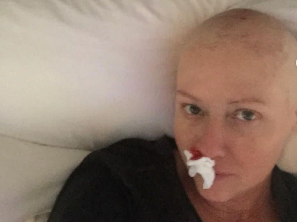 Shannen Doherty shares candid pictures of her cancer experiences (Shannen Doherty / @theshando / Instagram )