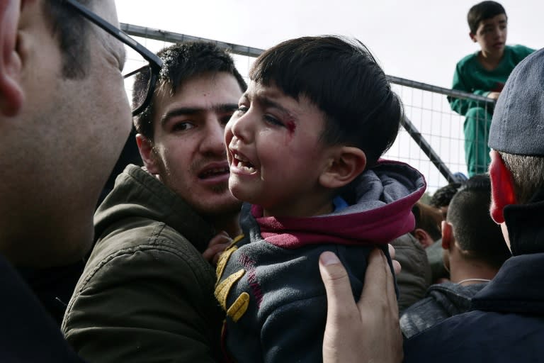 A slightly injured boy cries at a migrant protest against poor living conditions at a camp in Athens last year