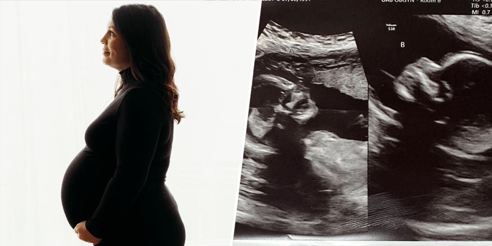 Kelsey Hatcher beside the sonogram of her rare double pregnancy. (Courtesy CJSHAVERPHOTO, LLC / Kelsey Hatcher)