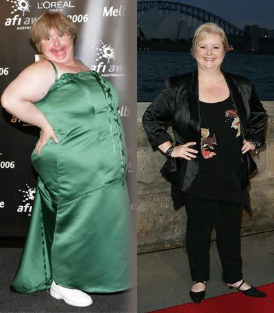 Magda Szubanski before and after Jenny Craig