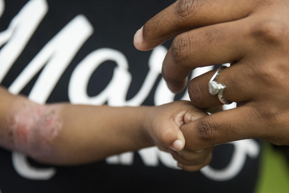 Jalayah Johnson, who lost her hospital job during the pandemic, holds onto her mother Tyesha Young in Waggaman, La., Friday, July 2, 2021. More than $7,000 behind on rent, Young had hoped a program in Louisiana would bail her out and allow her family to avert eviction in the coming weeks. But the 29-year-old mother of two from Jefferson Parish is still waiting to hear whether any of the $308 million available from the state for rental assistance and utility payments will give her a lifeline. She applied for money last year but never heard anything. ​(AP Photo/Sophia Germer)