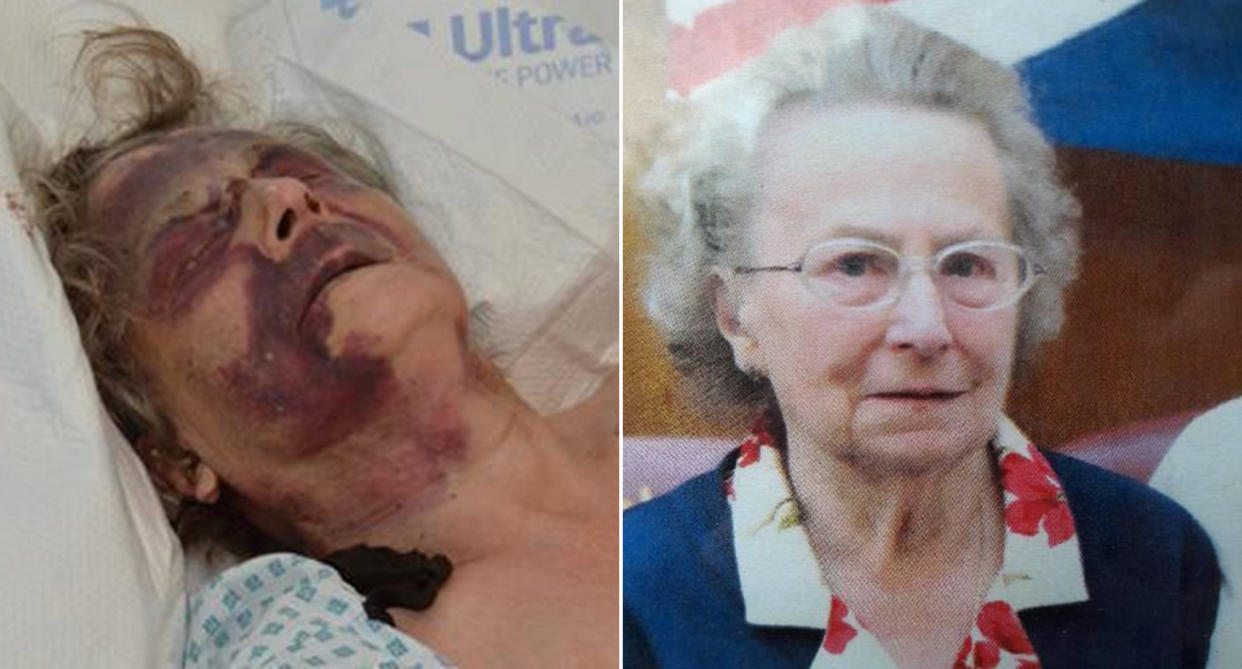 Iris Warner, pictured right before the attack, was left with heavy facial bruising after the attack. (Met Police)