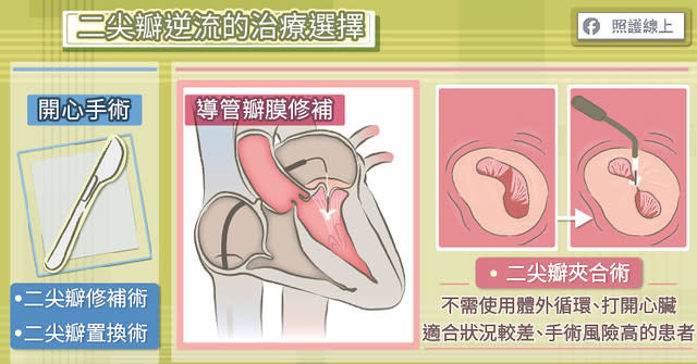 二尖瓣治療選擇
