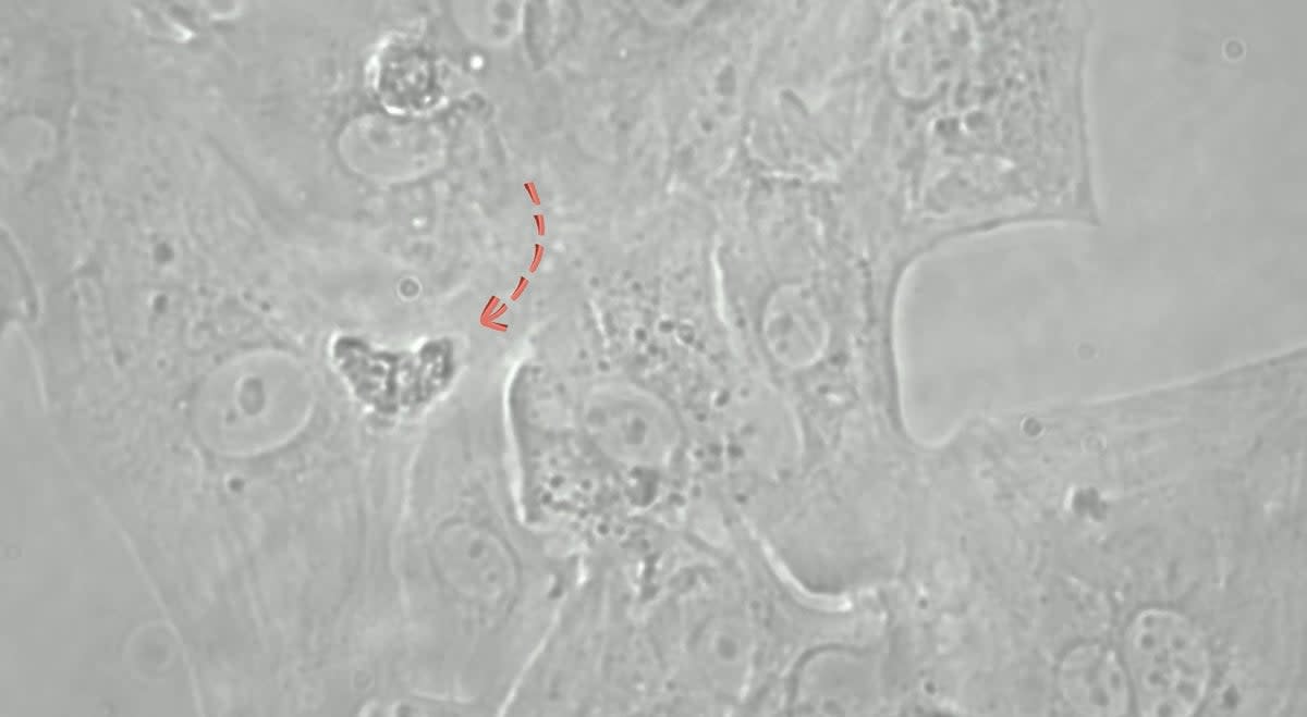 Image shows heart created by stem cells in a dish at UEL’s lab (University of East London)