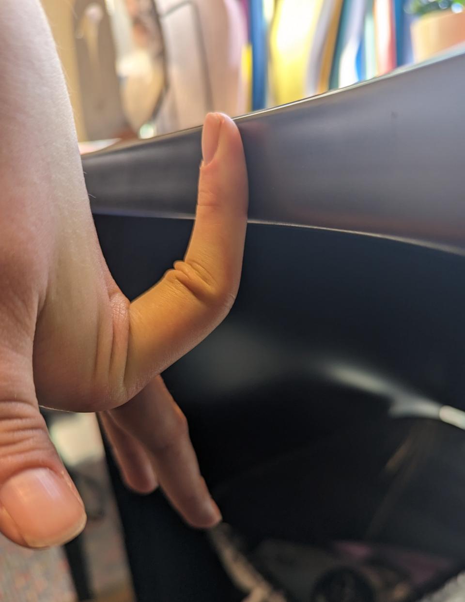 finger bending backwards