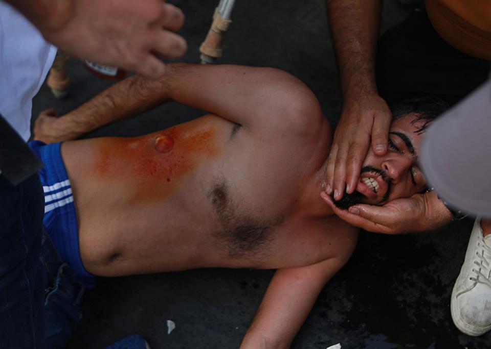 An injured protester is assisted after being shot by rubber bullets fired by security forces during a protest in Tahrir Square, in central Baghdad, Iraq, Tuesday, Oct. 1, 2019. Iraqi security forces fired rubber bullets and tear gas in Baghdad Tuesday on protesters demonstrating against corruption and poor public services injuring more than a dozen people, medical official said. (AP Photo/Khalid Mohammed)