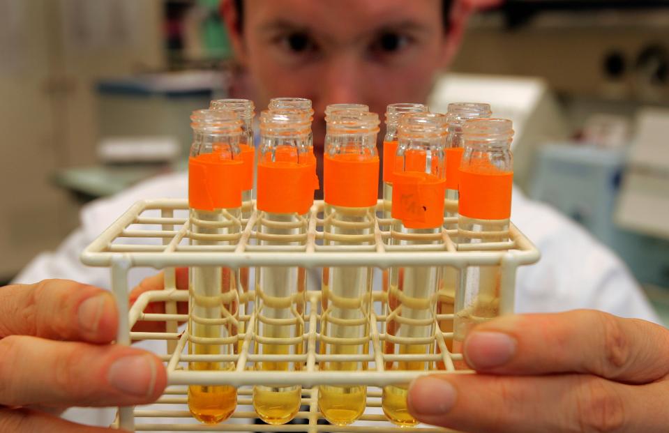 FILE - An Aug. 3, 2004 photo from files showing an unidentified laboratory assistant looking at urine tests at the WADA laboratories in Lausanne, Switzerland. FIFA’s medical chief, Michel D’Hooghe, says he is “really not happy” with drug-testing plans for the World Cup in Brazil, because samples taken from players must be flown across the Atlantic to a laboratory in Switzerland for analysis, possibly slowing results. FIFA had to turn to the lab in Lausanne because the Brazilian facility that was expected to analyze World Cup samples repeatedly failed to comply with World Anti-Doping Agency standards and so lost its authority to do testing.(AP Photo/Keystone, Fabrice Coffrini), File)