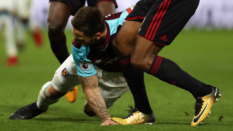 Arnautovic fell heavily on his hand. Pic: Getty