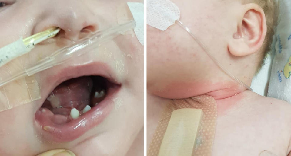 A mother claims hospital staff neglected her baby when they “didn’t notice” she had developed a bacterial infection, ulcers all over her mouth, and a neck rash in a matter of hours. Source: Lillians Harris Heart Journey/Facebook