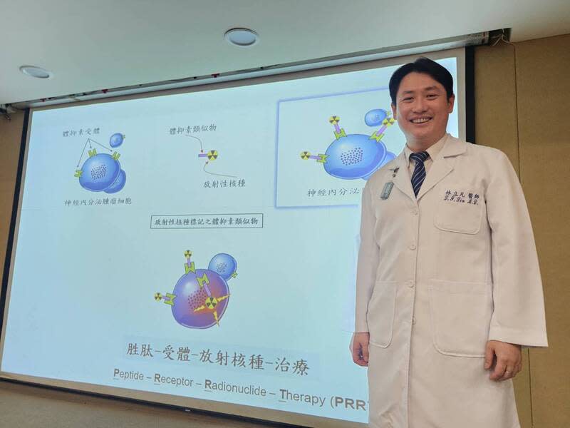 神經內分泌腫瘤診斷難  新個案半數已有轉移 三軍總醫院核子醫學部主治醫師林立凡20日指出，神 經內分泌腫瘤是會分泌荷爾蒙的惡性腫瘤，有可能在 人體許多器官中發現，且診斷困難，平均耗時5至7年 才被診斷出來，約一半新個案都已發現轉移。 中央社記者陳婕翎攝  112年7月20日 