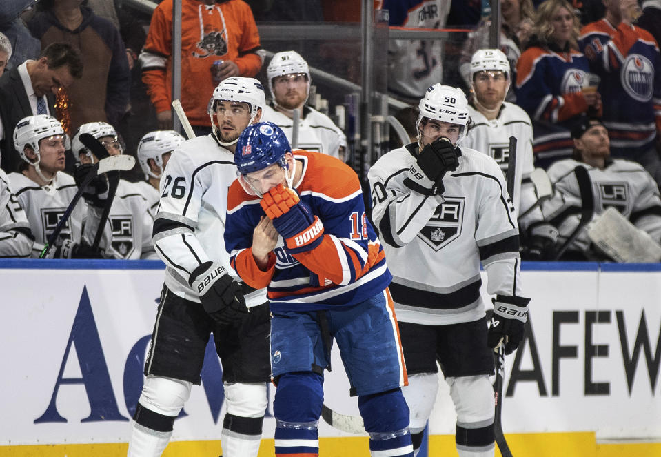 Edmonton Oilers' Zach Hyman (18) holds his face after the puck went off his face and into the net for a goal against the Los Angeles Kings during the second period of Game 5 of an NHL hockey Stanley Cup first-round playoff series Tuesday, April 25, 2023, in Edmonton, Alberta. (Jason Franson/The Canadian Press via AP