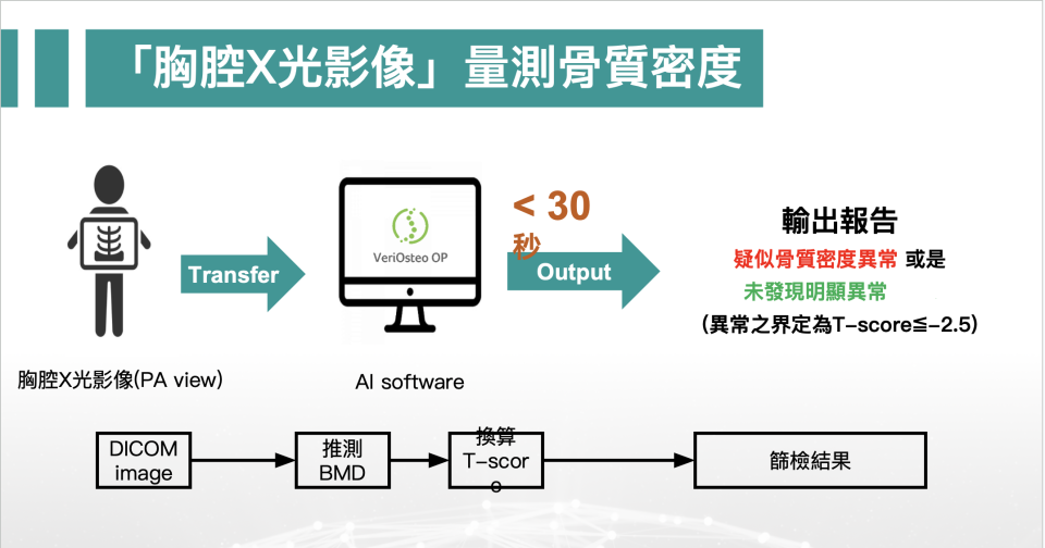 「VeriOsteo OP」軟體，僅需30秒就可測出骨質疏鬆。圖／台中榮總提供