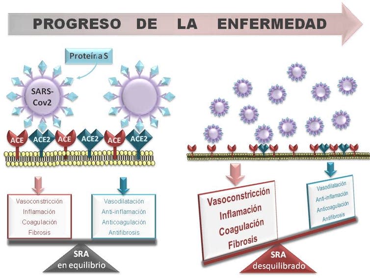 El Sistema Renina Angiotensina (RAS) en el progreso de la Covid-19.