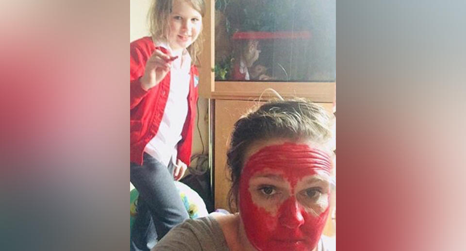 Halloween fail: Yorkshire mum Leanne Short's clown paint lip stain left her with a red face for days.