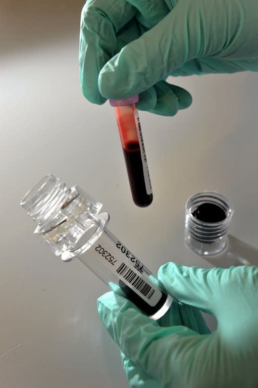 A blood sample is being handled at the Swiss Laboratory for Doping Analysis in Lausanne on February 25, 2009. Doping agencies urged Australian cheats to come clean Friday as concern mounted that everyone has been tarred with the same brush after a probe pointed to widespread drug use in professional sport