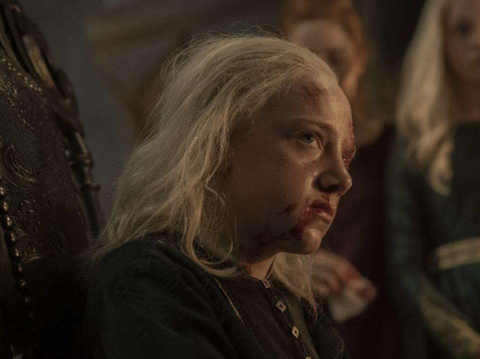 Leo Ashton as young Aemond Targaryen with a bloody face.