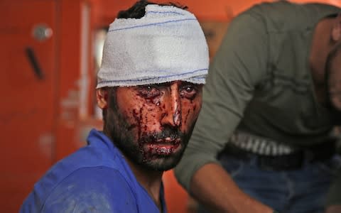 A Syrian man receives treatment on October 20, 2019, in the Syrian border town of Tal Abyad which was seized by Turkey-backed forces last week - Credit: AFP