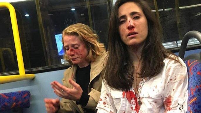 Melania Geymonat, 28, a Ryanair stewardess, right, and her girlfriend Chris, 29, were assaulted by a gang and left covered in blood after they refused to kiss. (Facebook)