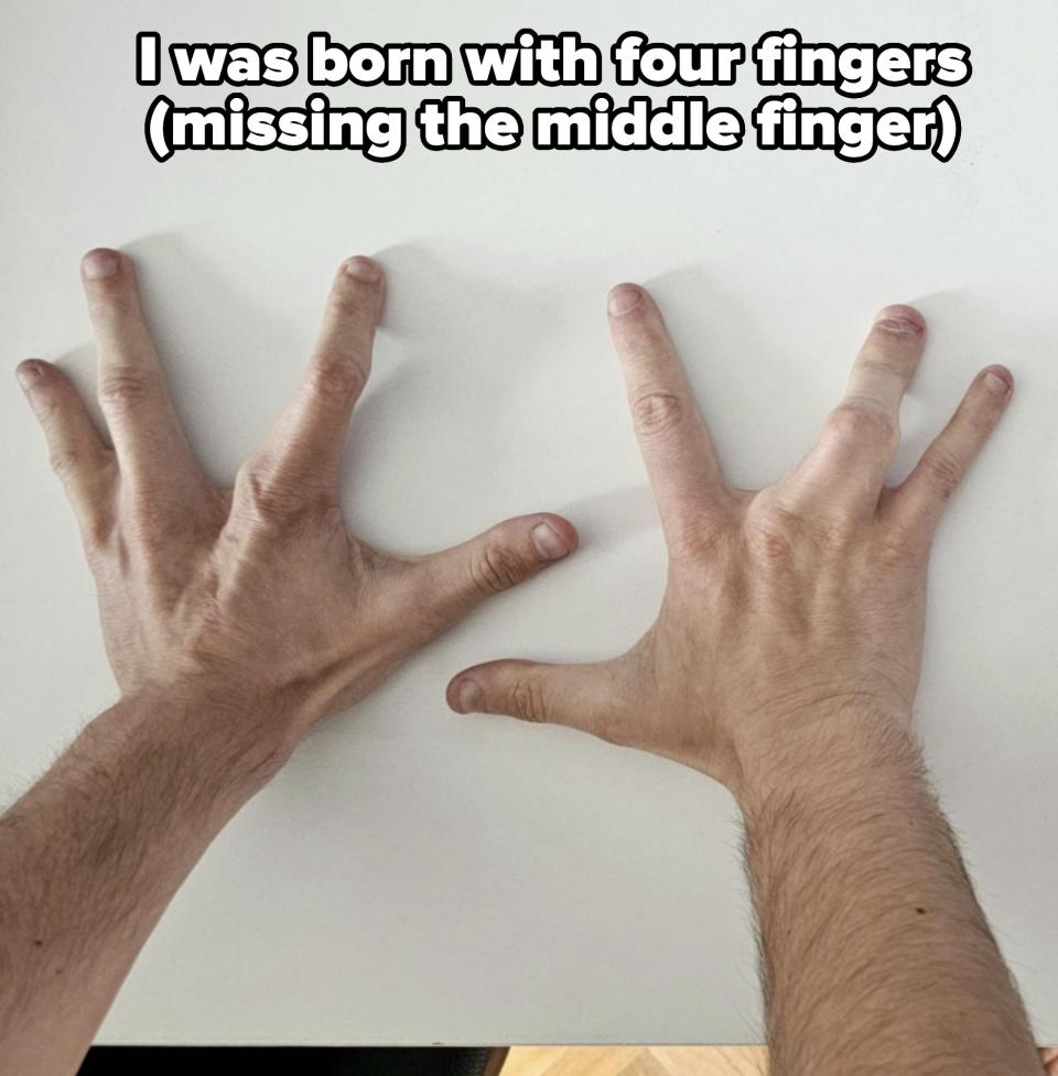 Two hands with bent fingers are placed palms down on a white surface