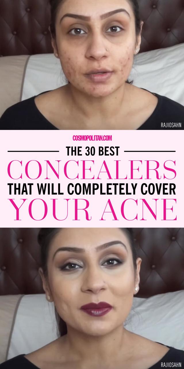 The 30 Best Concealers Will Completely Cover Your Acne