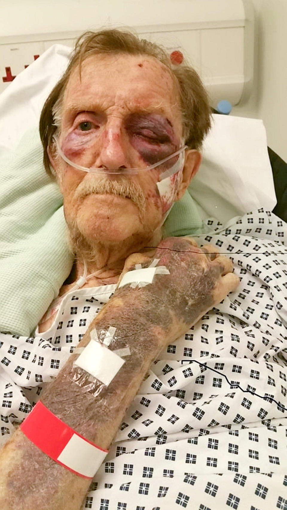 <em>Shocking – after the attack Staffordshire Police released shocking pictures of Mr Gumbley’s injuries as he lay in hospital (Picture: SWNS)</em>