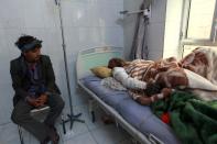 A Yemeni man receives treatment on April 1, 2015, at the burn unit of a hospital in Sanaa, following a reported airstrike by the Saudi-led coalition in the area of Yarim