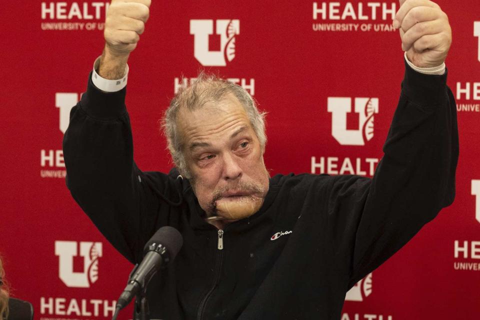 <p>Megan Nielsen/The Deseret News via AP</p> Rudy Noorlander gives two thumbs up at a press conference with his daughter, Ashley Noorlander, left, and surgeon to speak about his recovery from a grizzly bear attack at the University of Utah Hospital in Salt Lake City, on Friday, Oct. 13, 2023. 