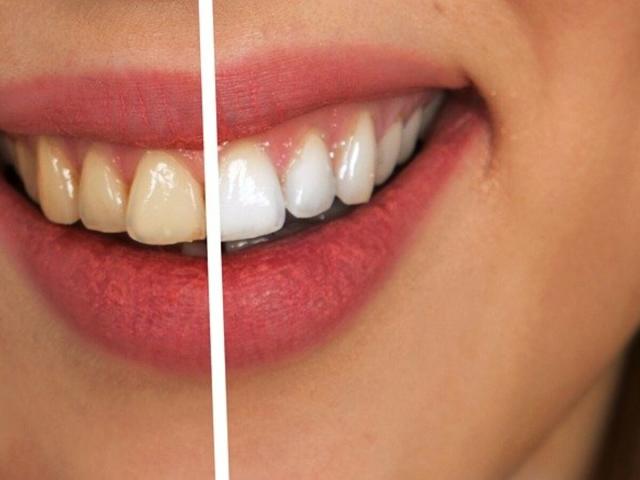 Voici les meilleures astuces pour blanchir ses dents sans produit chimique ?