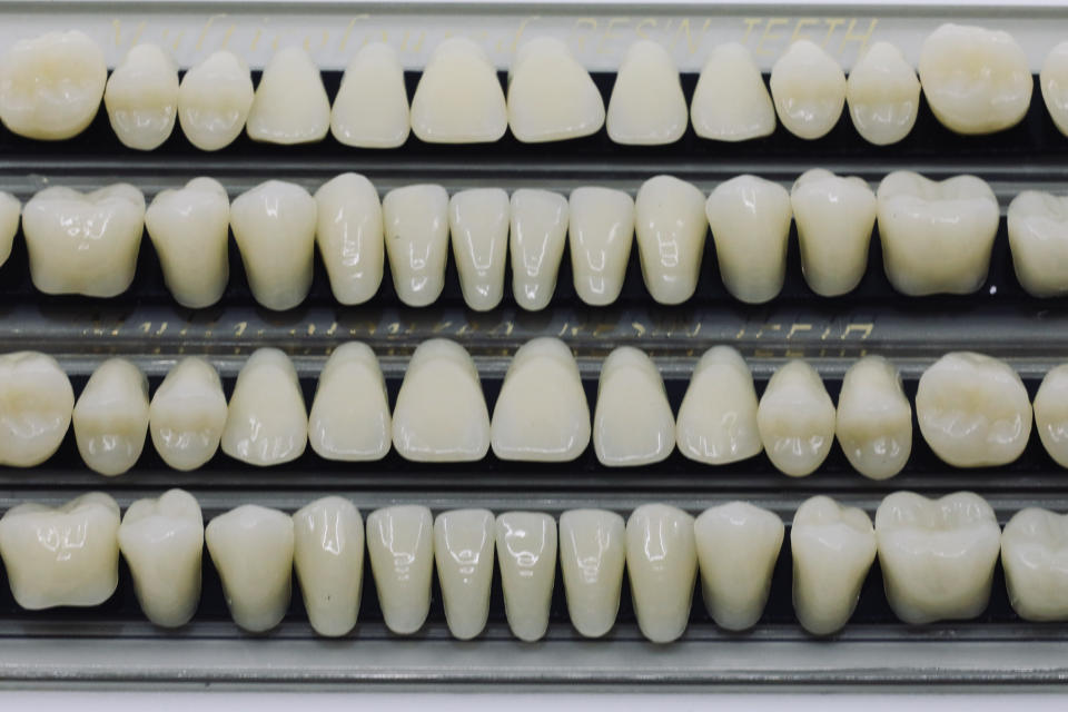 Assorted dental crowns and veneers displayed in rows