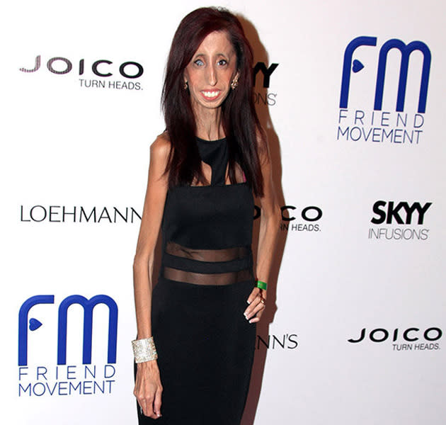 Lizzie Velasquez galt eins als „hässlichste Frau der Welt“ (Bild: Getty Images)