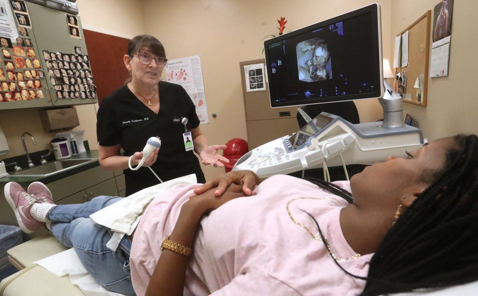 For the past decade, Daytona Beach Dr. Pam Carbiener has been one of the few Volusia County obstetricians who has accepted patients with a Medicaid insurance plan. Carbiener is pictured at Halifax OB/GYN Associates with patient Shar Quan Baker, who has a Medicaid plan, on May 25 as the two discuss the three-dimensional ultrasound image of Baker's baby.