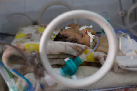 Newly born conjoined twins lie in an incubator at the child intensive care unit of al-Thawra hospital in Sanaa, Yemen February 6, 2019. REUTERS/Khaled Abdullah