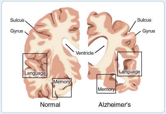 brain_cross_section_border.jpg